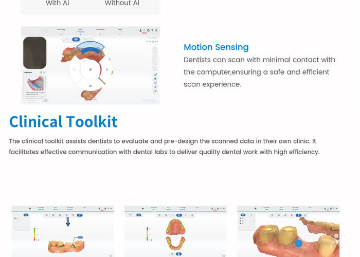 digital dental scaners (5).jpg