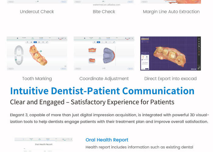 digital dental scaners (6).jpg