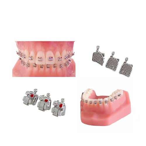 orthodontic brace (14).jpg