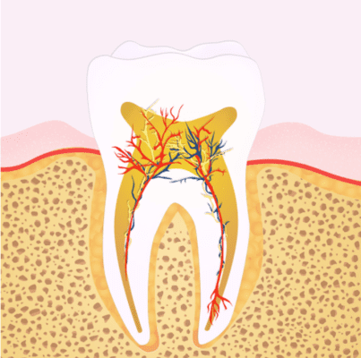 Contraindications and complications of orthodontics (1).png